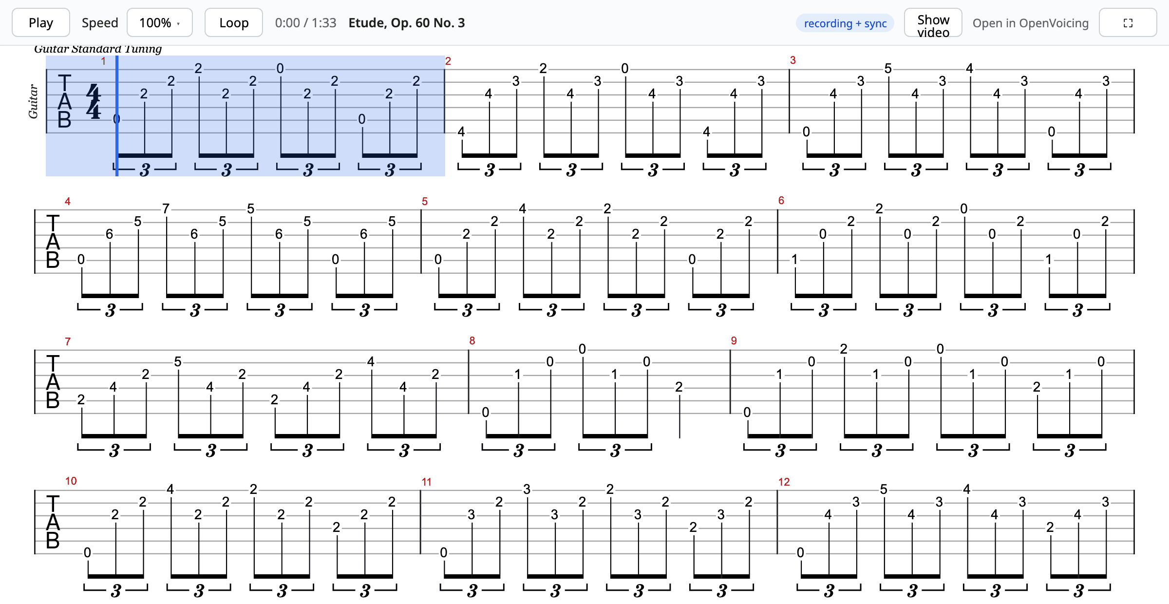 The interactive score player showing Carcassi, Op. 60 No. 3